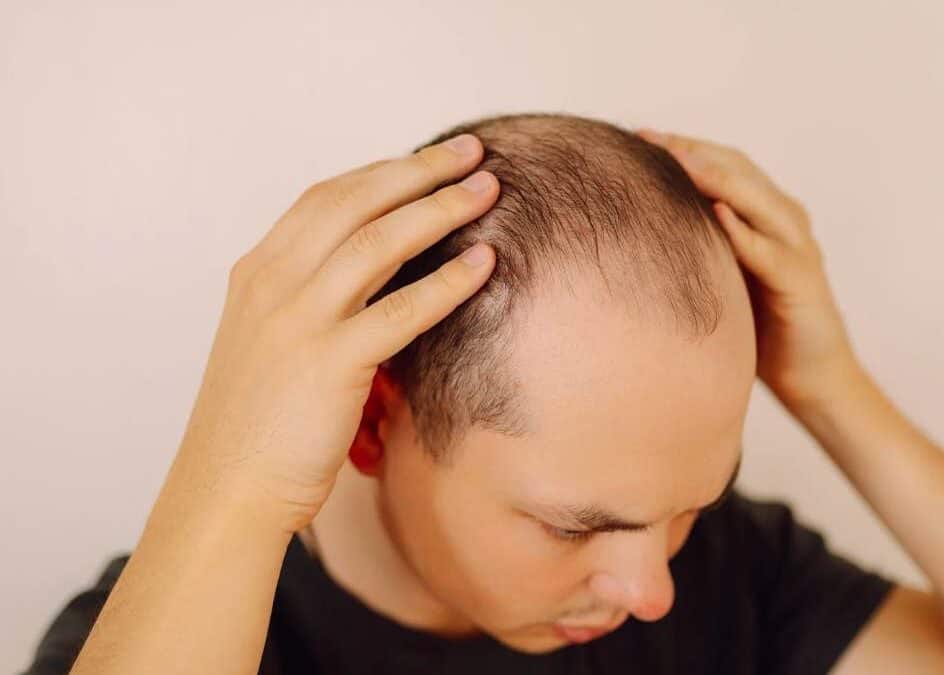 Caduta dei capelli: quando è normale e quando rivolgersi al dermatologo