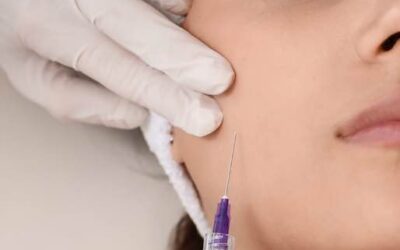 Botulino o filler: due trattamenti diversi, un obiettivo comune